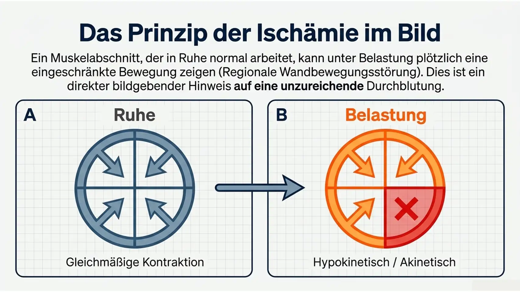 Belastungs-EKG & Stress-Echokardiographie: Ablauf und Aussagekraft 9 Slide8 new 3 Kardiologie Check – Herzgesundheit & Vorsorge